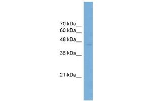 WB Suggested Anti-ARFGAP1 Antibody Titration: 0. (ARFGAP1 antibody  (Middle Region))