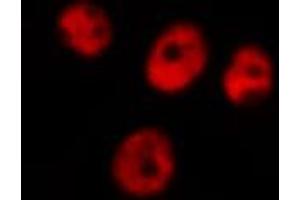 ABIN6266649 staining A549 by IF/ICC. (UBR5 antibody  (N-Term))