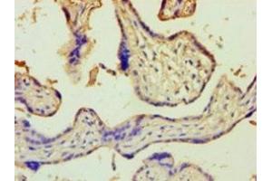 Immunohistochemistry of paraffin-embedded human placenta tissue using ABIN7176647 at dilution of 1:100 (ZNF265 antibody  (AA 1-320))