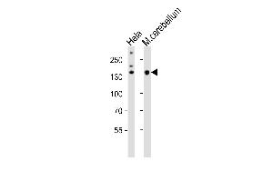 Western blot analysis of lysates from Hela cell line, mouse cerebellum tissue (from left to right), using Mouse Kdm6b Antibody (Center) (ABIN6243707 and ABIN6577624). (Kdm6b antibody  (AA 1023-1057))