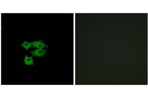 Immunofluorescence analysis of A549 cells, using LY6E antibody. (LY6E antibody  (Internal Region))