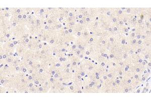 Detection of F2 in Human Liver Tissue using Monoclonal Antibody to Coagulation Factor II (F2) (Prothrombin antibody)