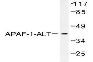 Image no. 2 for anti-Apoptotic Peptidase Activating Factor 1 (APAF1) antibody (ABIN265312) (APAF1 antibody)