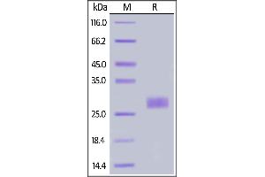 Human IL-33, His Tag on  under reducing (R) condition. (IL-33 Protein (AA 109-270) (His tag))