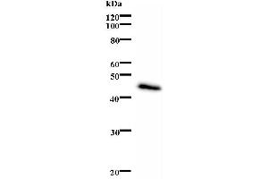 Western Blotting (WB) image for anti-Excision Repair Cross-Complementing Rodent Repair Deficiency, Complementation Group 6 (ERCC6) antibody (ABIN932472) (ERCC6 antibody)