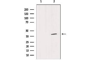 Western blot analysis of extracts from HepG2, using SFXN4 Antibody. (Sideroflexin 4 antibody  (N-Term))