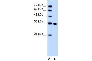 SLC25A29 antibody used at 1. (SLC25A29 antibody  (C-Term))