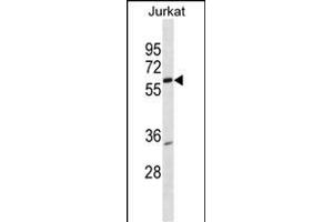PKNOX2 Antibody (Center) (ABIN1538267 and ABIN2849904) western blot analysis in Jurkat cell line lysates (35 μg/lane).