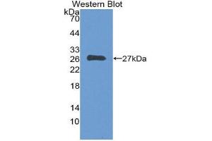 Western Blotting (WB) image for anti-Fms-Related tyrosine Kinase 3 (FLT3) (AA 334-543) antibody (ABIN1868002)