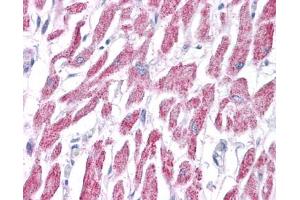 ACAT1 antibody was used for immunohistochemistry at a concentration of 4-8 ug/ml. (ACAT1 antibody  (Middle Region))