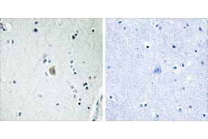 Peptide - + (CYP2E1 antibody)