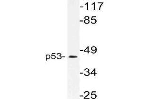 Western blot (WB) analysis of p53 antibody in extracts from 293 cells. (p53 antibody)
