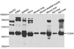 Western blot analysis of extracts of various cell lines, using TEAD4 antibody (ABIN5972288) at 1/1000 dilution. (TEAD4 antibody)