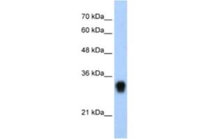 Western Blotting (WB) image for anti-Ribosomal Protein L8 (RPL8) antibody (ABIN2462054)