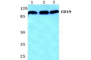Western Blot analysis of CD19 antibody at 1/500 dilution: Lane 1: MCF-7 cell lysate. (CD19 antibody)