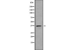 Western blot analysis SLC25A14 using K562 whole cell lysates