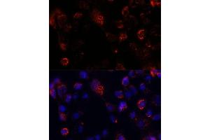 Immunofluorescence analysis of  cells using  antibody (ABIN7265429) at dilution of 1:100. (ACOT9 antibody  (AA 22-250))