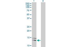 Western Blot analysis of NLGN4Y expression in transfected 293T cell line by NLGN4Y MaxPab polyclonal antibody.