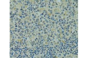 Immunohistochemistry of paraffin-embedded Human tonsil using IVNS1ABP Polyclonal Antibody at dilution of 1:100 (40x lens). (IVNS1ABP antibody)
