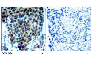 Image no. 2 for anti-Mitogen-Activated Protein Kinase 14 (MAPK14) (pThr180) antibody (ABIN197010) (MAPK14 antibody  (pThr180))