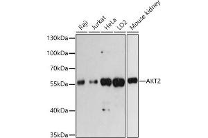 Western blot analysis of extracts of various cell lines, using  antibody (ABIN7271250) at 1:3000 dilution. (AKT2 antibody)