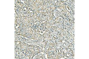 IHC analysis of MVP using anti-MVP antibody (ABIN7600481).