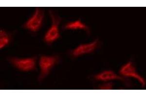 ABIN6275439 staining HeLa by IF/ICC. (RSAD1 antibody  (Internal Region))