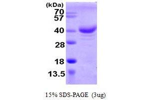 Zinc Finger, CCHC Domain Containing 17 (ZCCHC17) (AA 1-241) protein (His tag)