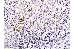 Immunohistochemistry (Paraffin-embedded Sections) (IHC (p)) image for anti-Keratin 1 (KRT1) (AA 141-240) antibody (ABIN733343)