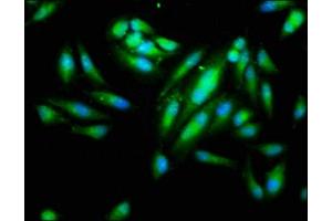 Immunofluorescence staining of Hela cells with ABIN7156207 at 1:266, counter-stained with DAPI. (IDO1 antibody  (AA 1-403))