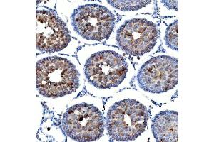 IHC analysis of TTLL2 using anti-TTLL2 antibody (ABIN7600850). (TTLL2 antibody  (AA 24-582))