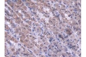 Detection of MTX1 in Rat Stomach Tissue using Polyclonal Antibody to Metaxin 1 (MTX1) (Metaxin 1 antibody  (AA 163-324))