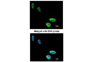 AP19041PU-N hnRNP-C1/C2 antibody staining of Paraformaldehyde-fixed HeLa by Immunofluorescence at 1/200 dilution. (HNRNPC antibody  (N-Term))