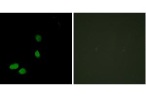 Immunofluorescence analysis of HeLa cells, using HMG17 antibody. (HMGN2 antibody)