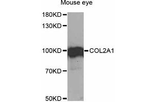 Western blot analysis of extracts of mouse eye, using COL2A1 antibody (ABIN1871948) at 1:1000 dilution. (COL2A1 antibody)