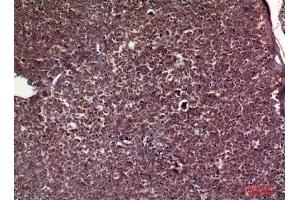 Immunohistochemistry (IHC) analysis of paraffin-embedded Human Pancreas, antibody was diluted at 1:100. (APOC3 antibody  (Internal Region))