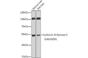 Western blot analysis of extracts of various cell lines, using Carbonic Anhydrase 9 (C/G250) antibody (ABIN6131267, ABIN6137799, ABIN6137801 and ABIN6218748) at 1:100 dilution. (CA9 antibody  (AA 52-151))