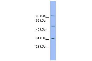 SLC25A25 antibody used at 1 ug/ml to detect target protein. (SLC25A25 antibody)