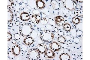Immunohistochemical staining of paraffin-embedded Kidney tissue using anti-PSMC3 mouse monoclonal antibody. (PSMC3 antibody)