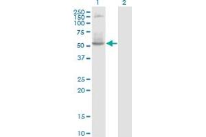 Western Blot analysis of DNTT expression in transfected 293T cell line by DNTT monoclonal antibody (M01), clone 4H5. (TdT antibody  (AA 1-110))