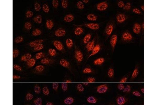 RBM25 antibody