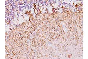 Formalin-fixed, paraffin-embedded human Cerebellum stained with Neurofilament Mouse Monoclonal Antibody (NF421). (NEFH antibody)