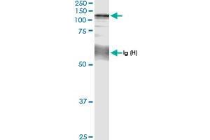 Immunoprecipitation of CC2D1A transfected lysate using anti-CC2D1A MaxPab rabbit polyclonal antibody and Protein A Magnetic Bead , and immunoblotted with CC2D1A MaxPab rabbit polyclonal antibody (D01) . (CC2D1A antibody  (AA 1-951))