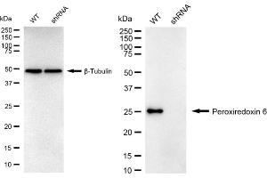 Western blotting analysis using Peroxiredoxin 6 antibody (ABIN7799781). (Recombinant Peroxiredoxin 6 antibody)
