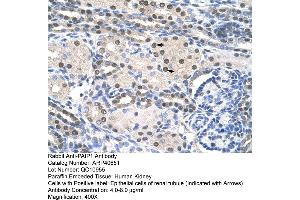 Rabbit Anti-PAIP1 Antibody  Paraffin Embedded Tissue: Human Kidney Cellular Data: Epithelial cells of renal tubule Antibody Concentration: 4. (PAIP1 antibody  (C-Term))