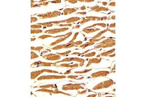 (ABIN6242565 and ABIN6578213) staining PGM1 in human heart tissue sections by Immunohistochemistry (IHC-P - paraformaldehyde-fixed, paraffin-embedded sections). (Phosphoglucomutase 1 antibody  (AA 469-501))