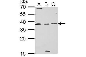 WB Image Livin antibody detects BIRC7 protein by Western blot analysis.