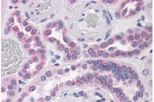 Human Kidney: Formalin-Fixed, Paraffin-Embedded (FFPE) (GPR3 antibody  (AA 1-331))