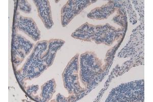 Immunohistochemistry (IHC) image for anti-Glutathione S-Transferase mu 1 (GSTM1) (AA 1-218) antibody (ABIN7436879)