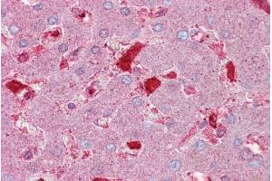 Immunohistochemistry with Liver tissue at an antibody concentration of 5µg/ml using anti-SERPINC1 antibody (ARP41402_P050) (SERPINC1 antibody  (Middle Region))